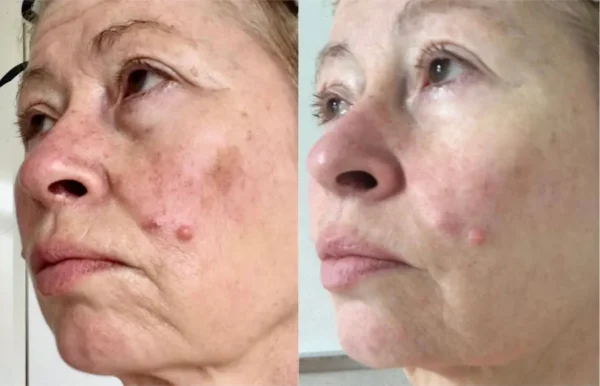 Organic Argan Wrinkle Rehab Serum 30ml | Collagen-Boosting Ceramide-Rich Plant Formula